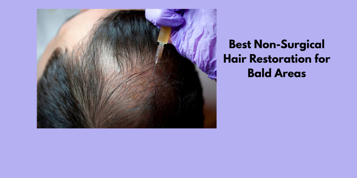 Best Non-Surgical Hair Restoration for Bald Areas