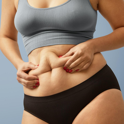 Abdominoplasty in Islamabad, Pakistan | Best Weight Loss Surgery