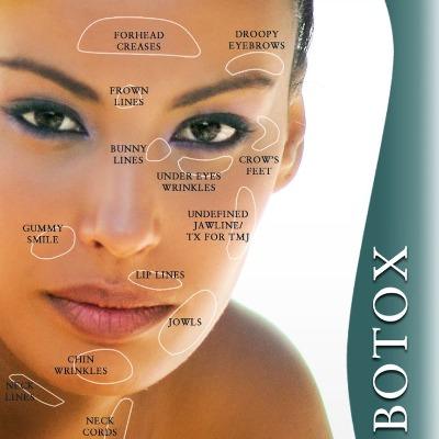 Botox Injection in Islamabad – Cost, Benefits & Best Clinics