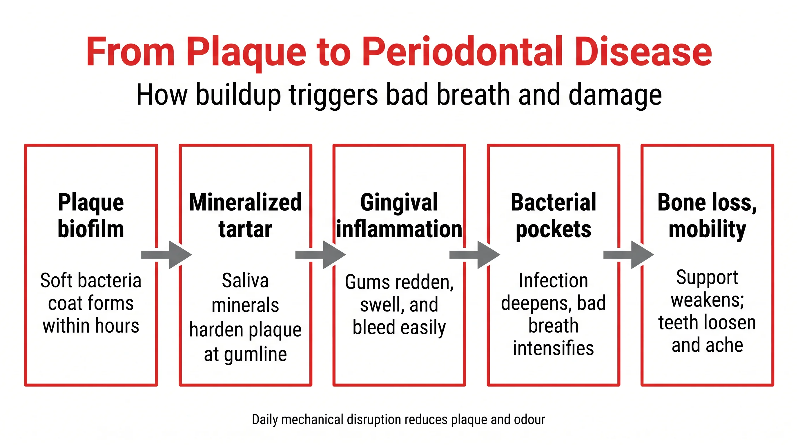 From Plaque to Periodontal Disease