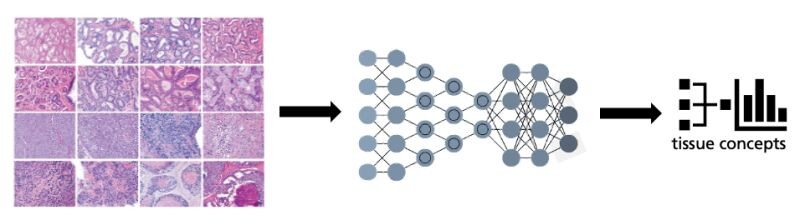 Schematic visualization of the tissue concepts pipeline with (from left to right) H&E-stained images, neural network, and statistical symbols.