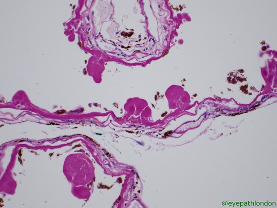Histology image, commentary in post.