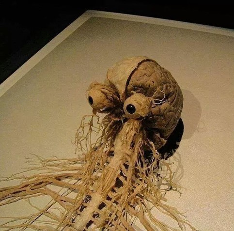 Brain and nervous system dissected out of a person.
