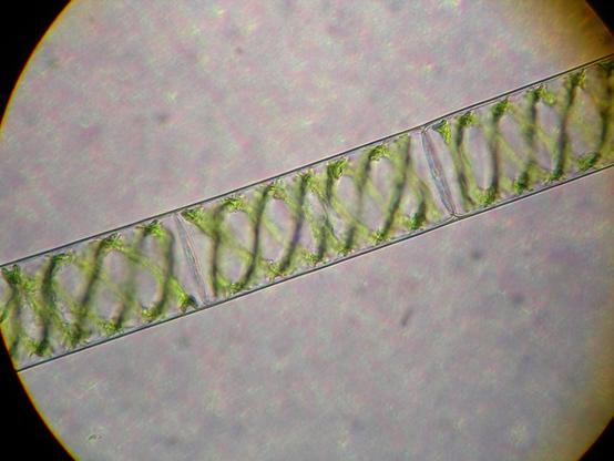 image/jpeg a view through a microscope of an algal filaments that contains two very green spirals in a double helix, similar to the structure of DNA.
The charophyte green algae Spirogyra. Public Domain.