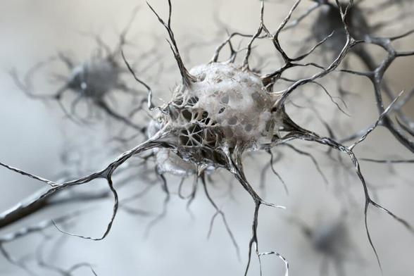 This shows a neuron.