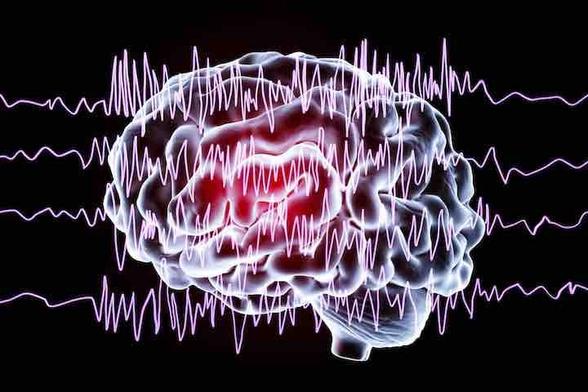 Brain and brain waves in epilepsy, illustration