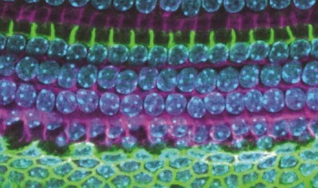 This shows cells in the inner ear.