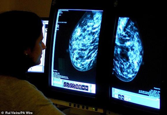 Experts from the Society of Radiographers (SoR) have suggested that male health workers should be allowed to perform mammograms to help tackle staff shortages