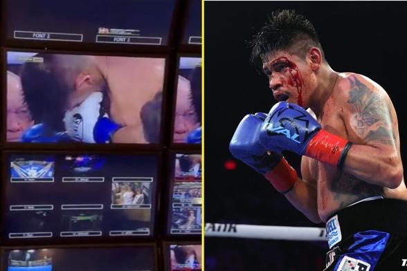 Boxing world title fight plunged into controversy after incorrect ruling on horror cut