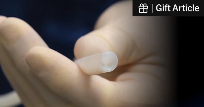 A Symvess lab-grown blood vessel is made from a mesh tube seeded with cells from the human heart.