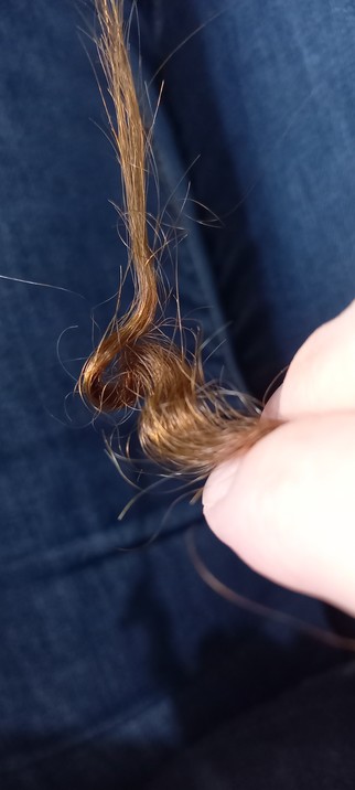 Photo shows a strand of my hair, which was plaited overnight. There is a sharp bend doubling back over itself which I cannot straighten. My hair in this photo is light brown because of the bleach I have inadvertently applied along with blue dye. The dye colour faded, the bleach remains.