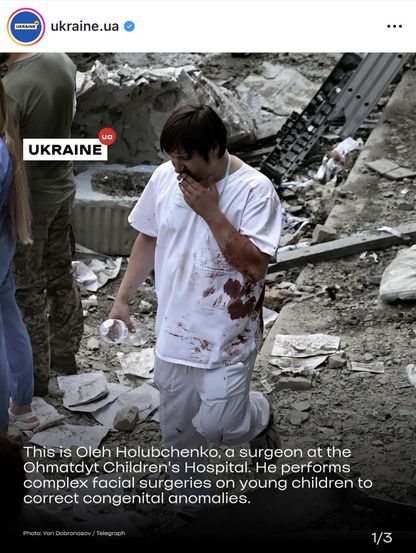 During the Russian missile attack, Oleh Holubchenko was operating on a child. The blast wave threw him against the operating table, but he and his colleagues did everything necessary to save the child.
