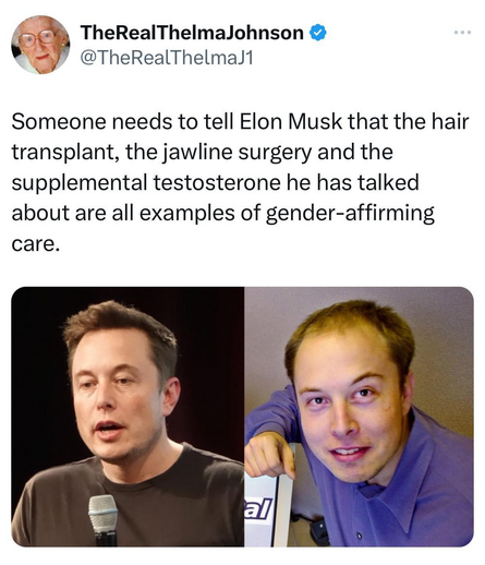 TheRealThelmaJohnson & @TheRealThelmaJ1 Someone needs to tell Elon Musk that the hair transplant, the jawline surgery and the supplemental testosterone he has talked about are all examples of gender-affirming care. 