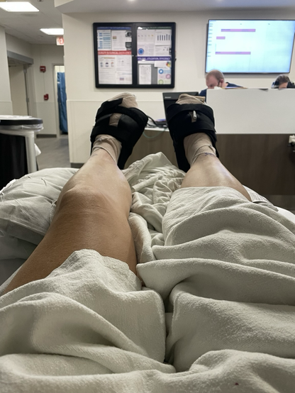Two bandaged feet after bunion surgery.
