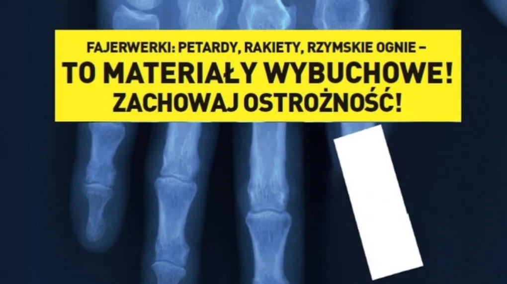 Fajerwerki? Korzystaj rozsądnie! (wideo)