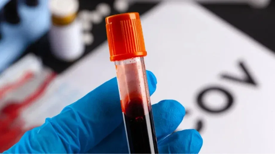 Aktualna sytuacja epidemiologiczna w powiecie ostrowskim. Zobacz najnowsze dane