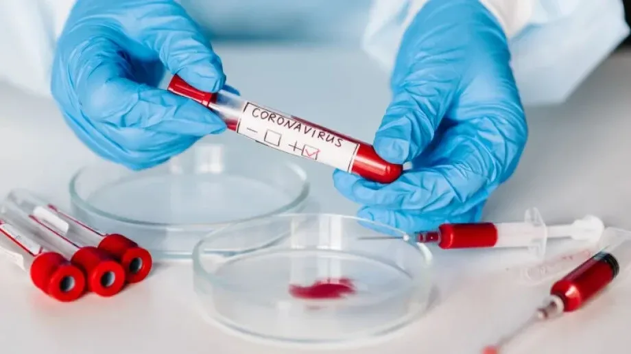Pierwsza partia polskich testów na COVID-19 powinna zostać wyprodukowana w przyszłym tygodniu
