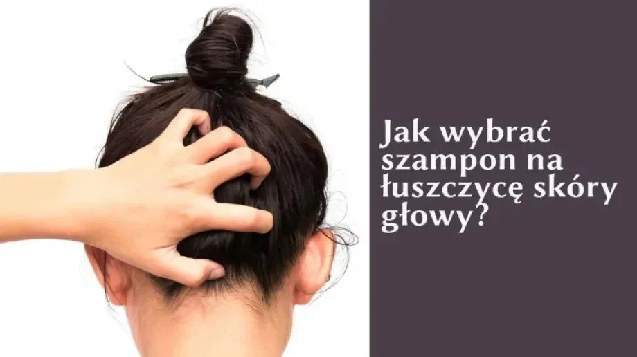 Szampon na łuszczycę - jak go wybrać?