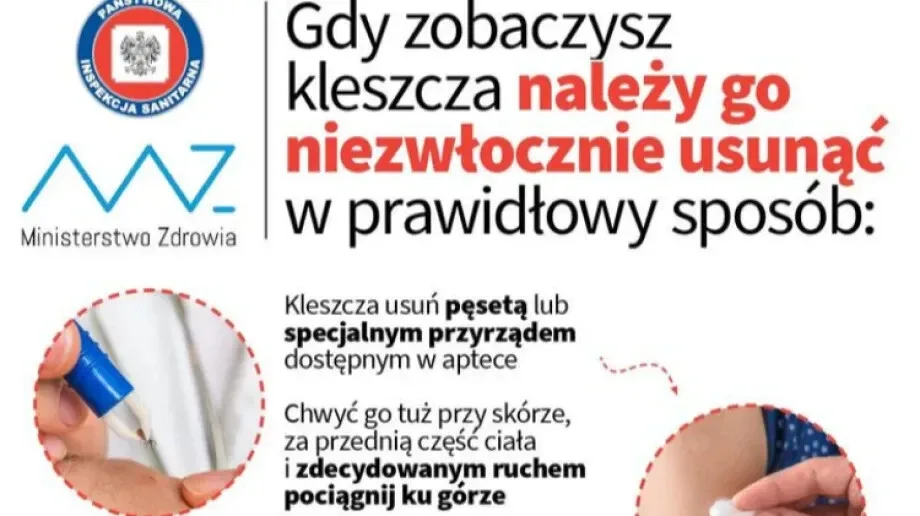 Jak prawidłowo pozbyć się kleszcza? Ministerstwo Zdrowia radzi