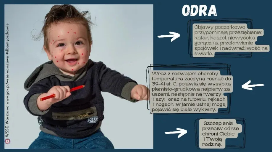 Odra to poważna choroba - nie lekceważ jej!