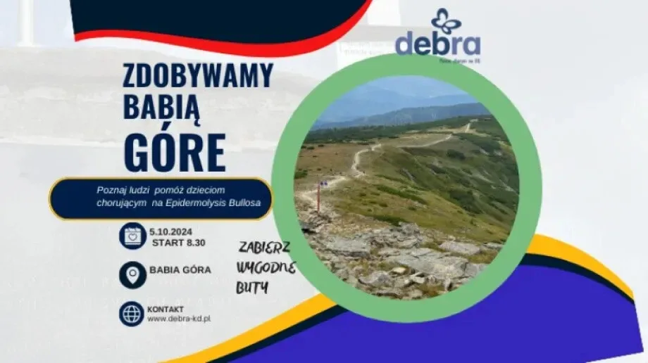 'Motylkowe' wyzwanie. Wspólna droga na Babią Górę dla dzieci z EB
