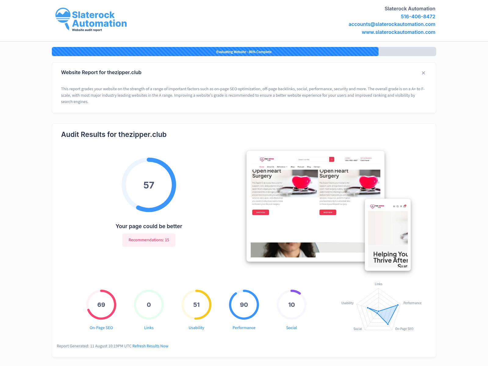 A screenshot of The Zipper Club website showcasing support resources for heart surgery patients.